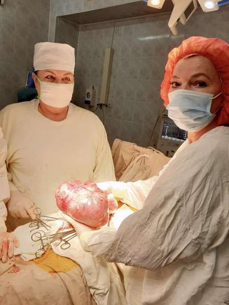 У Луцькій лікарні 40-річній жінці видалили шестикілограмову пухлину (фото 18+)