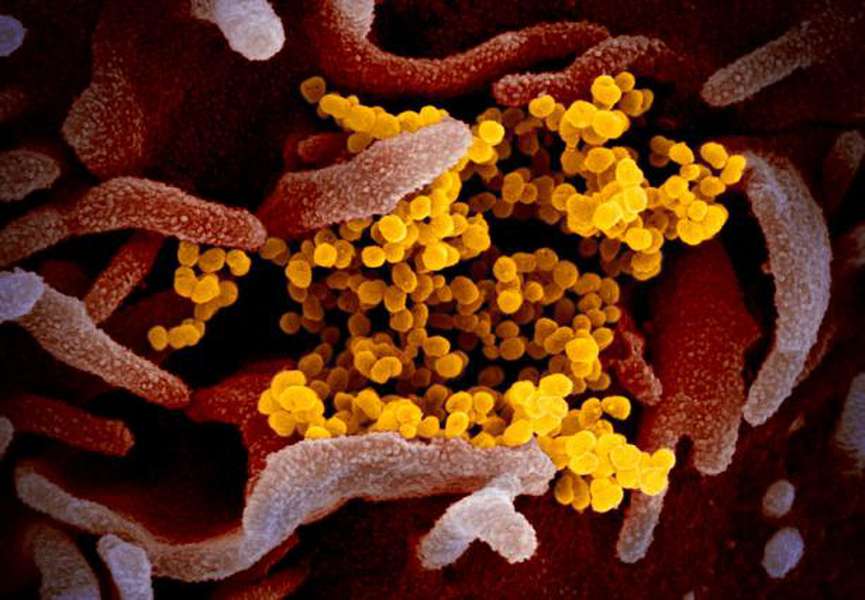Показали нові фото, як виглядає коронавірус під мікроскопом
