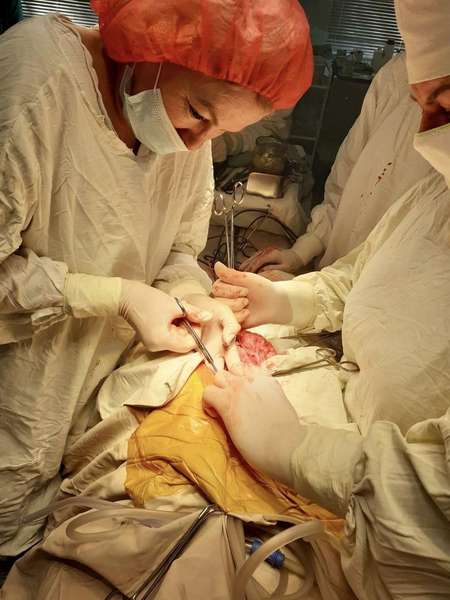 У Луцькій лікарні 40-річній жінці видалили шестикілограмову пухлину (фото 18+)