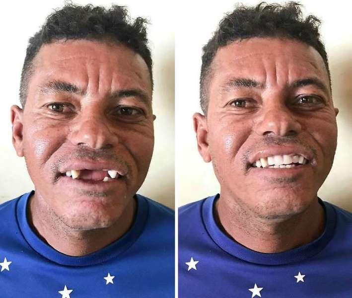 Неймовірна трансформація: стоматолог безкоштовно робить гарні зуби бідним людям (фото)