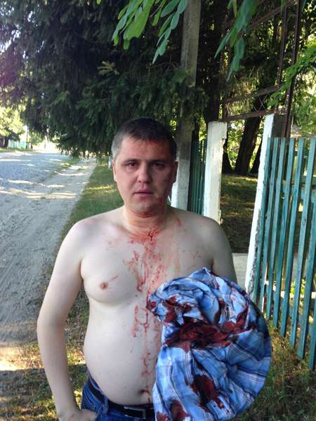 Луцькому комуністу Кононовичу розбили голову в Чернігові (відео, фото)
