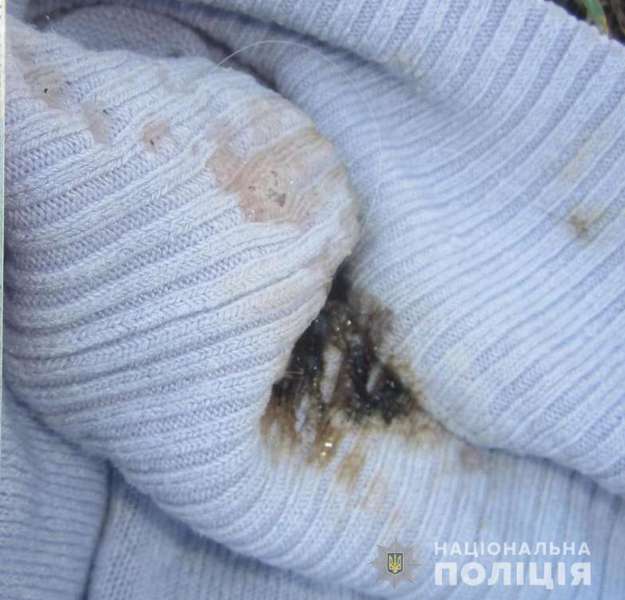Через ревнощі: на Київщині чоловік бризнув дружині в лице кислотою