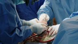 Кардіохірурги з Волині практикуються в Англії (фото)