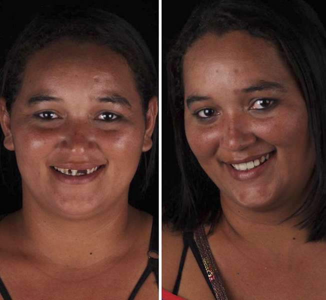 Неймовірна трансформація: стоматолог безкоштовно робить гарні зуби бідним людям (фото)