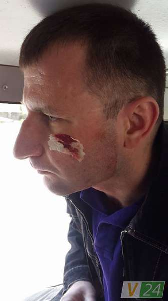 На Тернопільщині побили журналістів луцького телеканалу (фото)