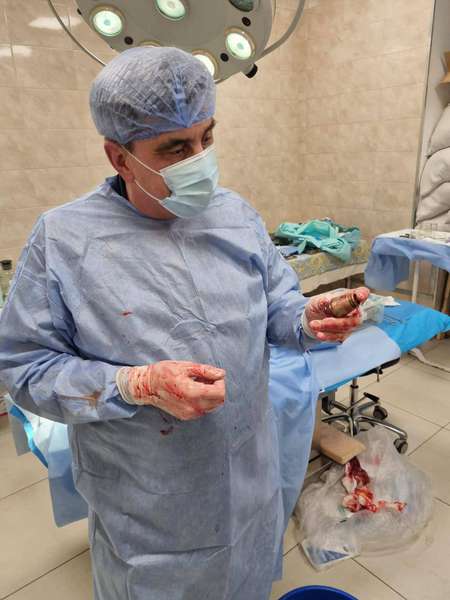 Українські лікарі під наглядом саперів видаляли з грудей бійця ЗСУ гранату ВОГ (фото)
