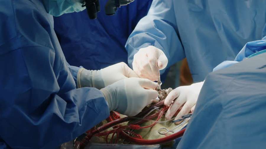 Кардіохірурги з Волині практикуються в Англії (фото)