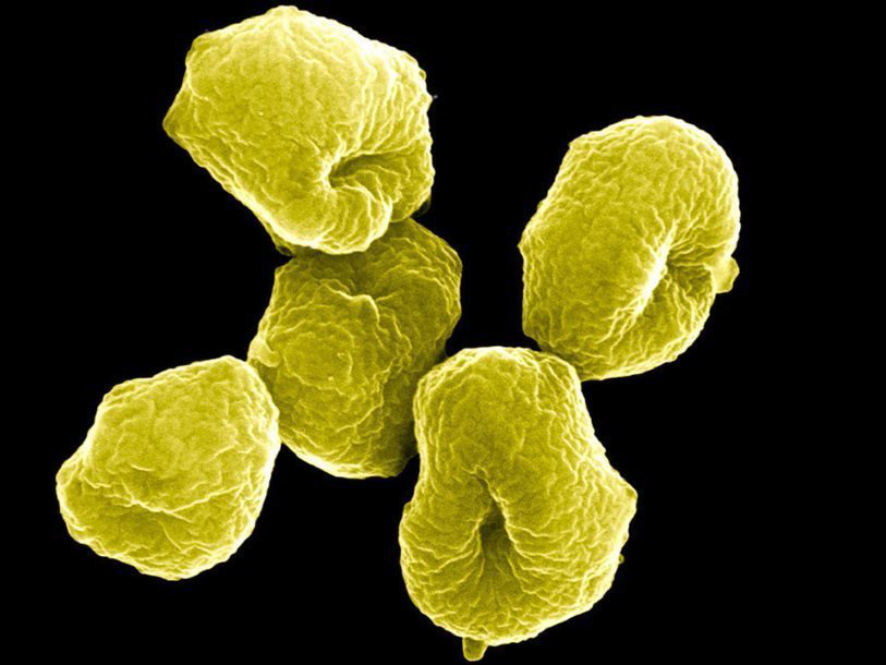 Щаслива випадовість: учені відкрили нове царство мікроорганізмів