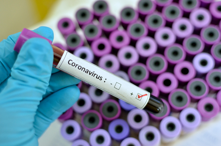 На Волині нема нових підозр на коронавірус, – ОДА