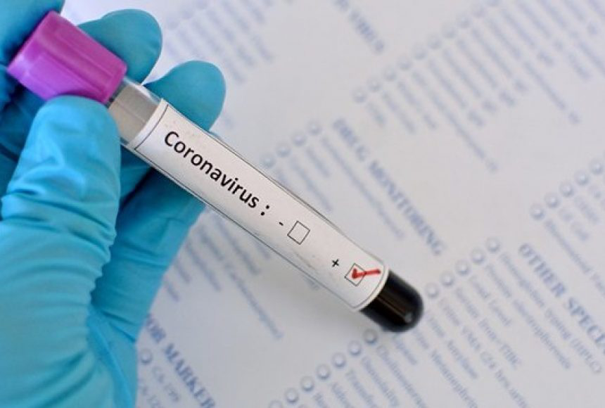 Скільки на Волині коштуватимуть експрес-тести на виявлення коронавірусу