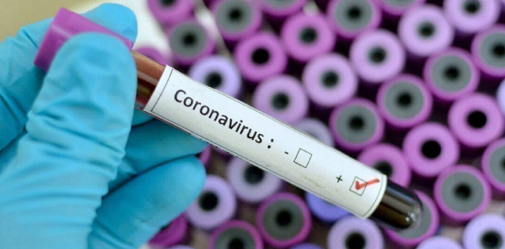 В Україні – третя смерть від коронавірусу. Всього випадків зараження – 21
