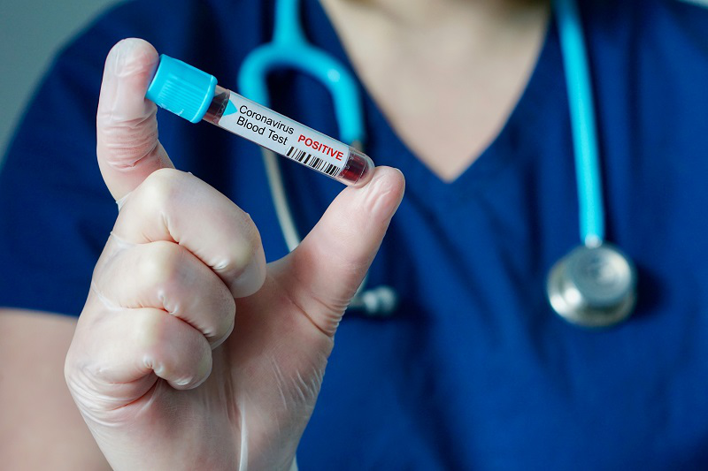 Луцька інфекційна лікарня отримала результати тестів на коронавірус