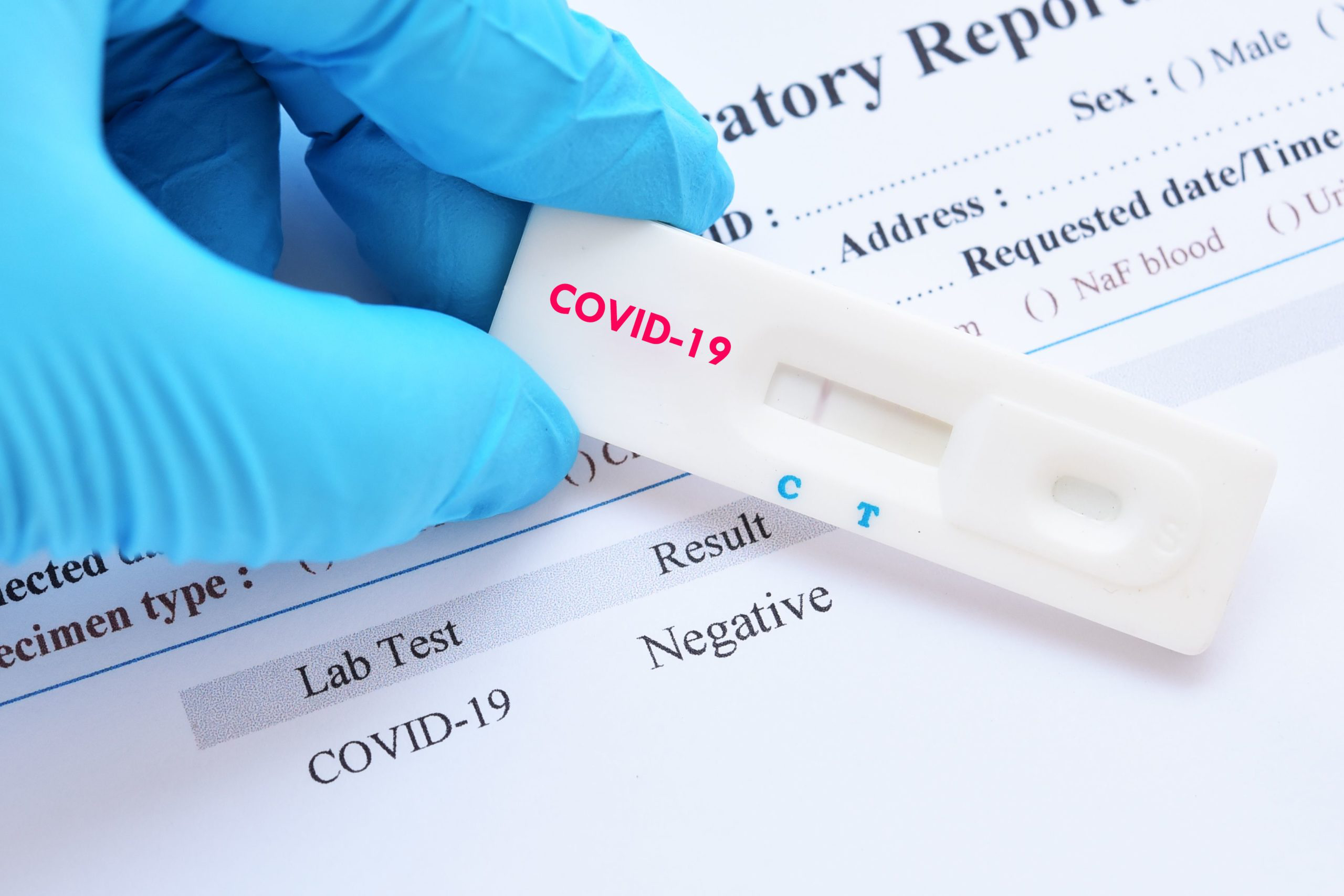 Відомо, чи заразилися батьки волинянки з коронавірусом