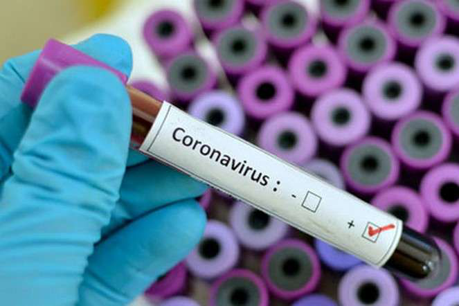 На Рівненщині 9 випадків зараження коронавірусом