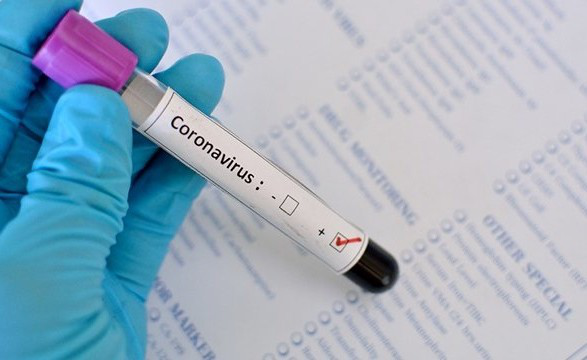 Смерть 19-річного волинянина від коронавірусу: деталі епідрозслідування