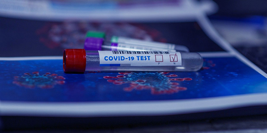 В Україні – 648 випадки коронавірусу за добу
