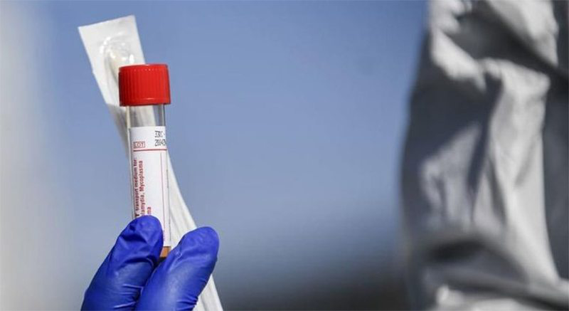 На Волині за добу – 55 нових випадків коронавірусу і три смерті