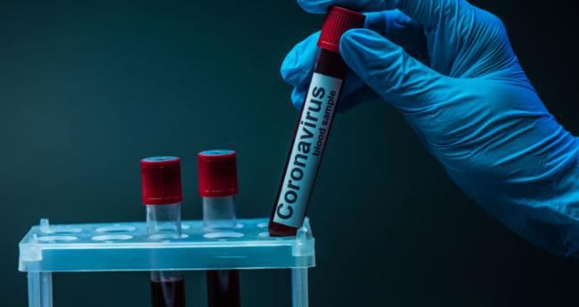 За добу на Волині 50 нових випадків коронавірусу і одна смерть