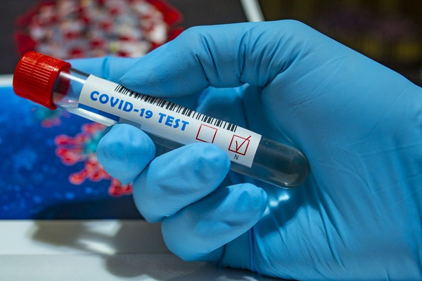 Дві лучанки померли від коронавірусу: свіжі дані