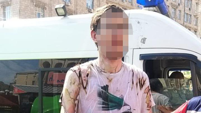 Під час урочистостей в центрі Києва чоловік підпалив себе