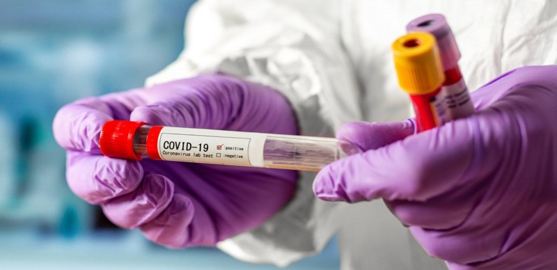За добу в Україні – 15 908 нових випадків коронавірусу