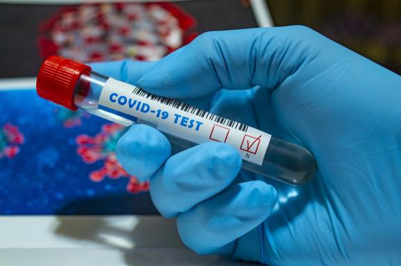 За добу в Україні – 26 488 нових випадків коронавірусу