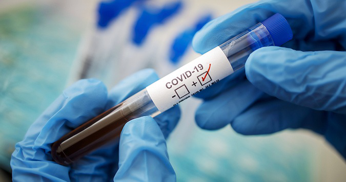 За добу в Україні – 1804 нових випадків коронавірусу і 114 смертей