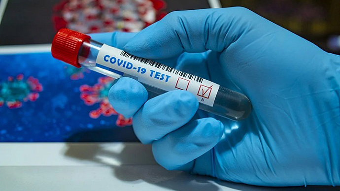 За добу в Україні – 25 789 нових випадків коронавірусу