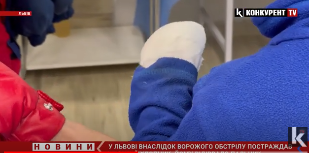 Хлопчику відірвало пальчик: що відомо про поранених внаслідок ракетних ударів у Львові (відео)