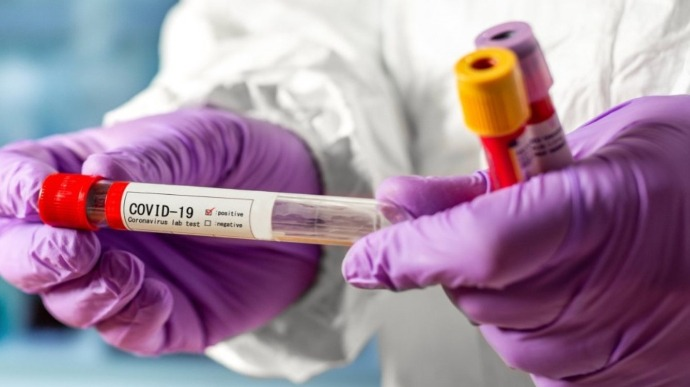 На Волинь привезли понад тисячу доз вакцини від COVID-19