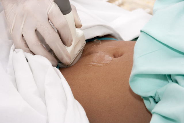 Дитина росла в кишківнику: жінка випадково дізналася про позаматкову вагітність на 23 тижні